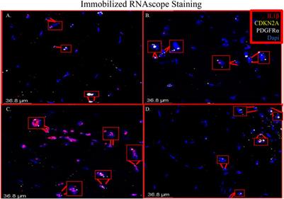 Hindlimb Immobilization Increases IL-1β and Cdkn2a Expression in Skeletal Muscle Fibro-Adipogenic Progenitor Cells: A Link Between Senescence and Muscle Disuse Atrophy